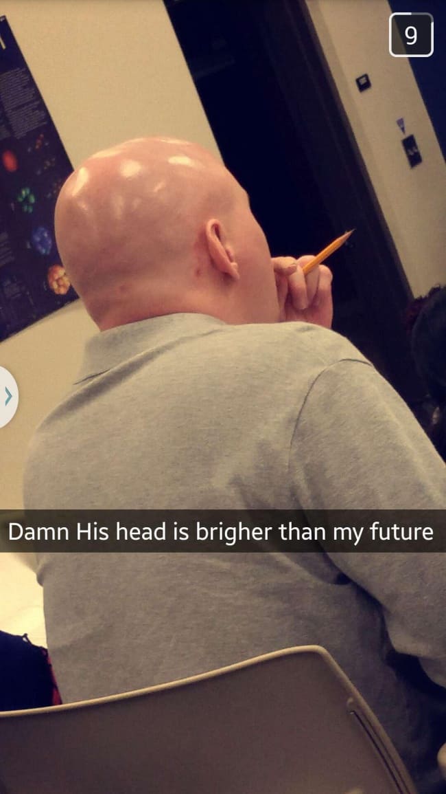 lonracha_bald_head