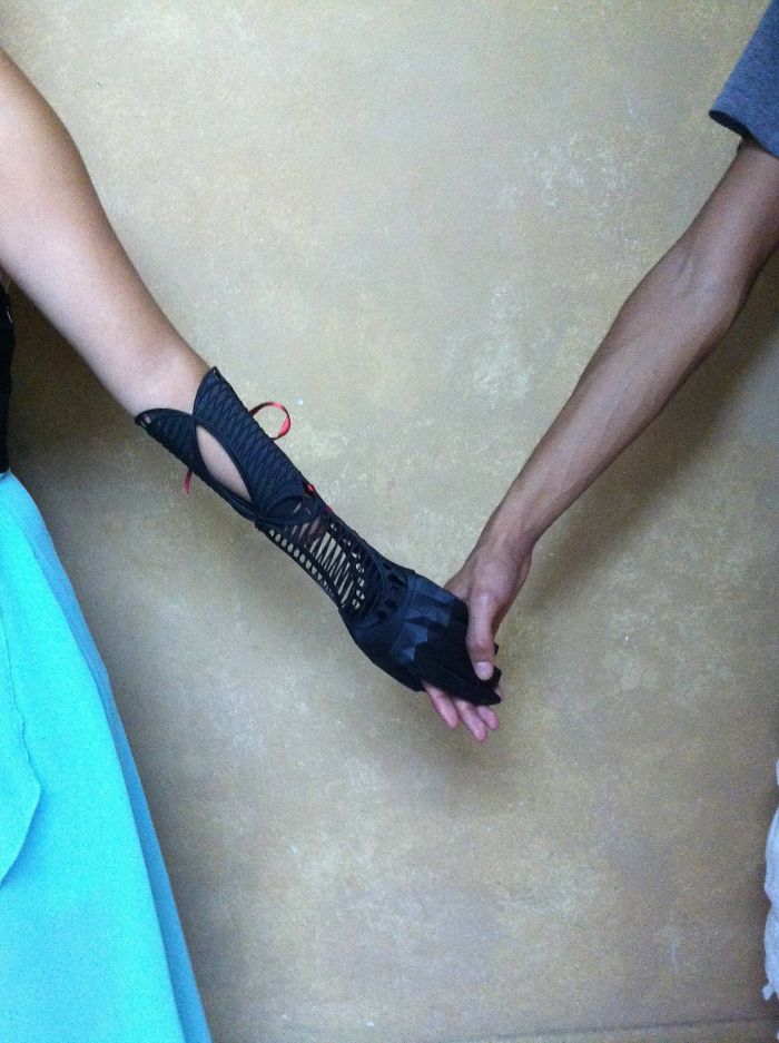 Impresionante brazo protésico de impresión 3d