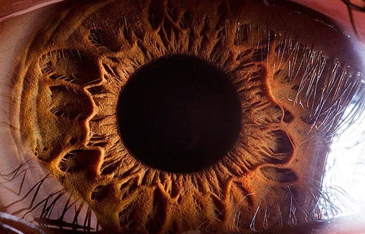Imágenes psicodélicas con zoom en el globo ocular
