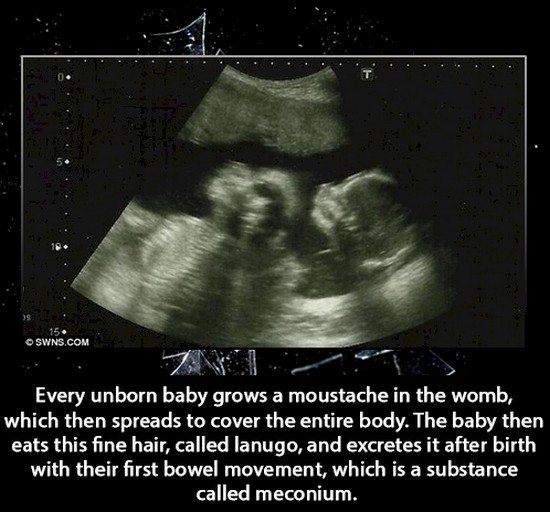 ultrasonido de un bebe 