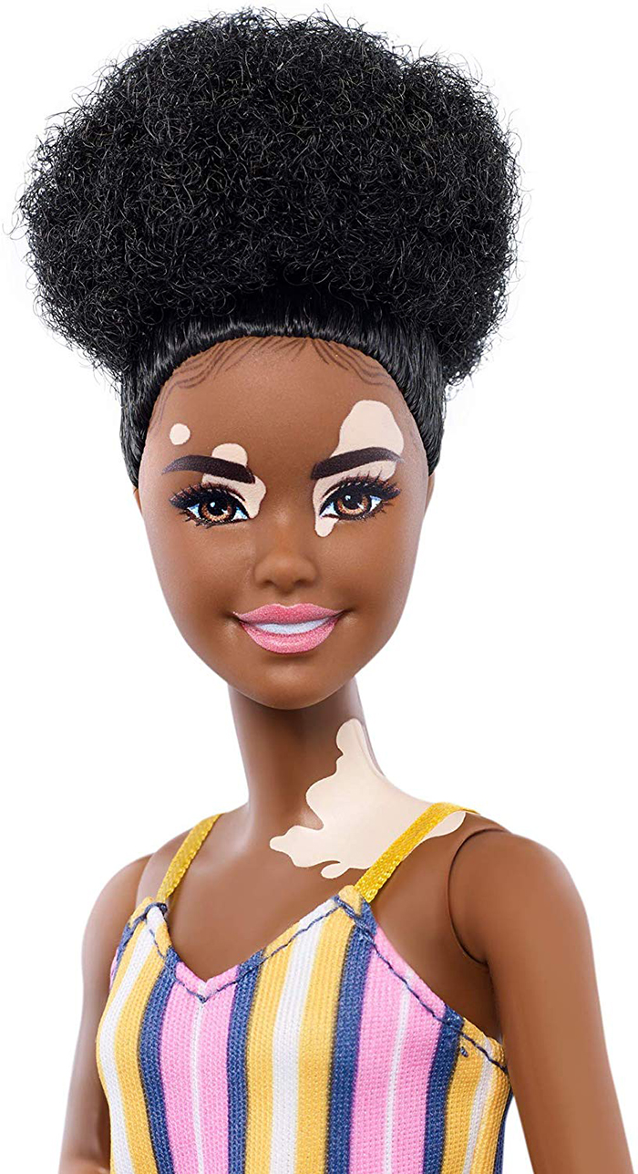 Barbie vitiligo con pelo rizado